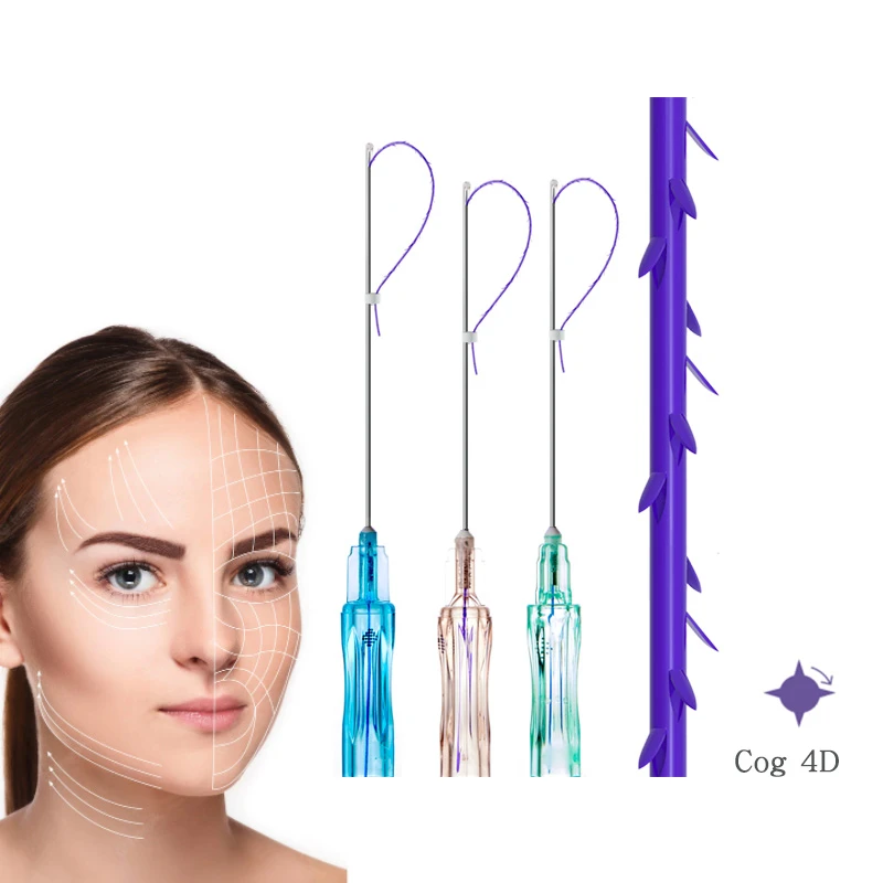 Zahnrad 4D-Gewinde