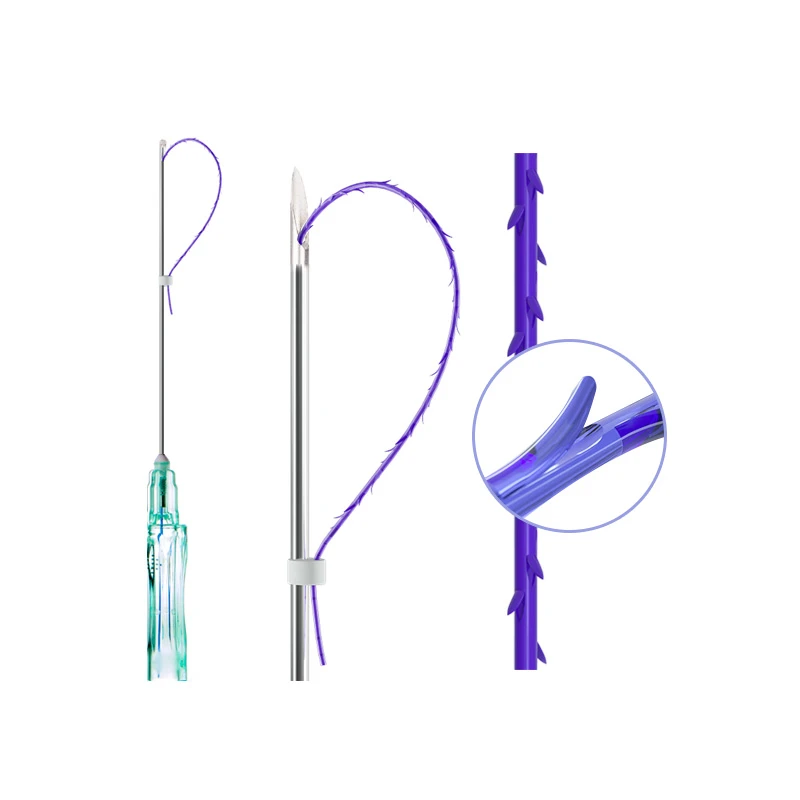Zahnrad-3D-Thread
