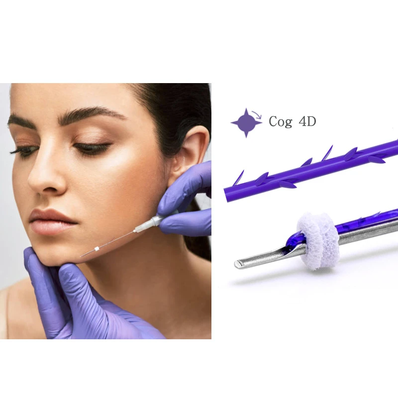 PDO Cog 4D Facial Lift: Erweitertes Fadenlifting f&uuml;r die Kieferkonturierung