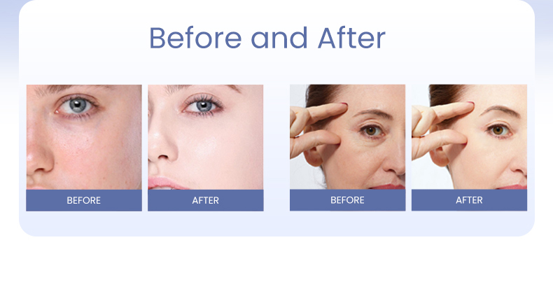 PDRN-Skinbooster