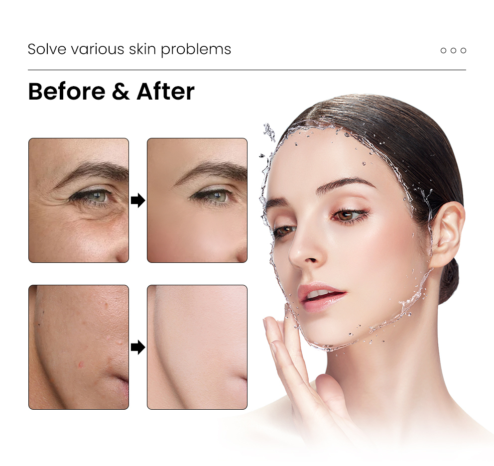 4D-Hyaluronsäure-Skinbooster