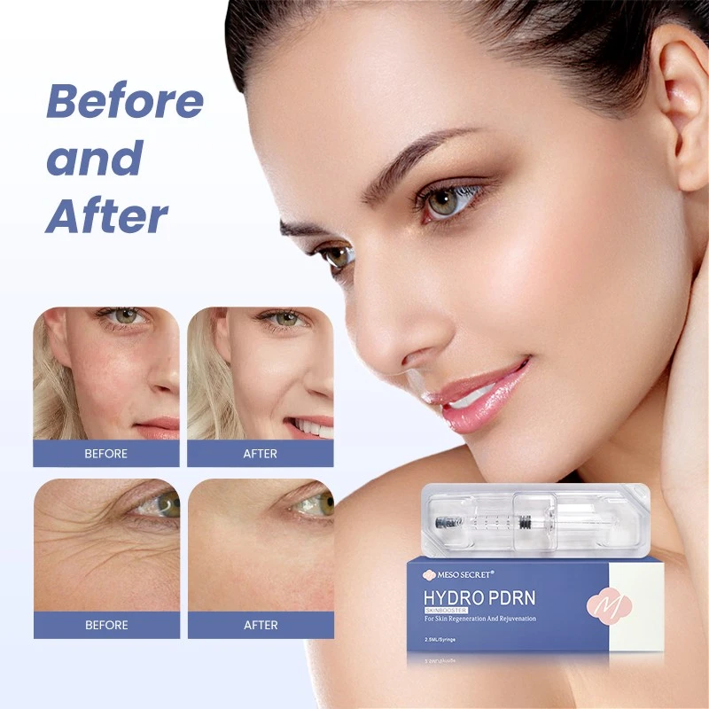 PDRN-Skinbooster