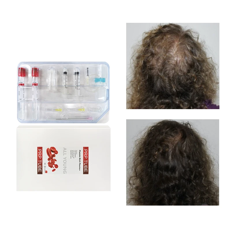 15ML PRP Tube Kit ACD GEL Koreanischer Zulieferer