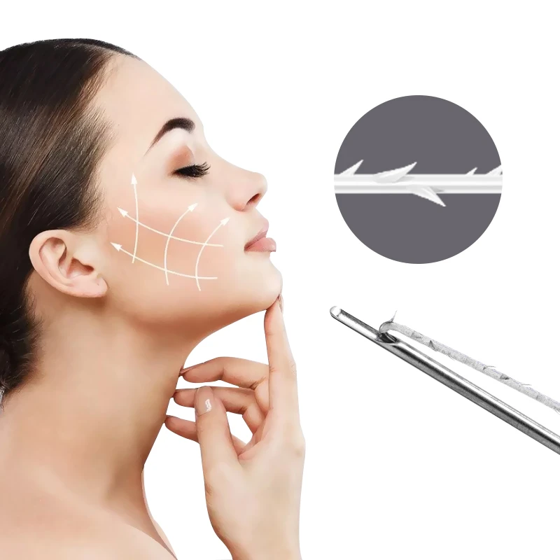 PCL-Zahnrad mit 6D-Gewinden, starkes Facelift-Gewinde mit Widerhaken
