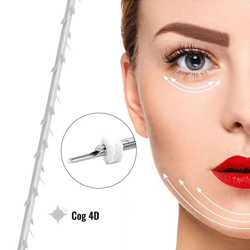 PCL-Zahnrad mit 6D-Gewinden, starkes Facelift-Gewinde mit Widerhaken